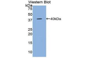Western Blotting (WB) image for anti-Chemokine (C-C Motif) Ligand 5 (CCL5) (AA 24-91) antibody (ABIN3209288) (CCL5 anticorps  (AA 24-91))