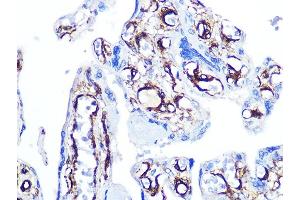 Immunohistochemistry of paraffin-embedded human placenta using Caldesmon Rabbit mAb (ABIN7266024) at dilution of 1:100 (40x lens). (Caldesmon anticorps)