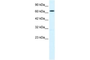 Western Blotting (WB) image for anti-Potassium Intermediate/small Conductance Calcium-Activated Channel, Subfamily N, Member 2 (KCNN2) antibody (ABIN2461098) (KCNN2 anticorps)