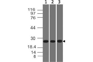 Image no. 1 for anti-ES cell expressed Ras (ERAS) (AA 1-210) antibody (ABIN5027194) (ERAS anticorps  (AA 1-210))