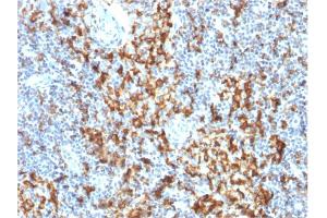 Formalin-fixed, paraffin-embedded human Lymph Node stained with CD163 Mouse Monoclonal Antibody (M130/1210).