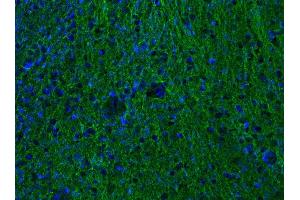 Indirect immunostaining of PFA-fixed mouse brain section (dilution 1 : 500; green).