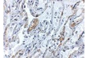 Immunohistochemistry of TNFAIP3 in human lung tissue with this product at 5 μg/ml. (TNFAIP3 anticorps  (Center))