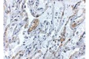 Immunohistochemistry of TNFAIP3 in human lung tissue with this product at 5 μg/ml.