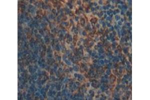 Used in DAB staining on fromalin fixed paraffin- embedded Kidney tissue