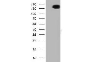 Western Blotting (WB) image for anti-L1 Cell Adhesion Molecule (L1CAM) antibody (ABIN1499086) (L1CAM anticorps)