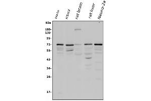 Western blot analysis of POT1 using anti-POT1 antibody (ABIN3043444). (POT1 anticorps  (N-Term))