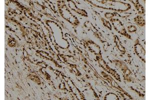 ABIN6277733 at 1/100 staining Human kidney tissue by IHC-P. (RAD21 anticorps  (C-Term))