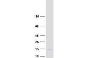 Validation with Western Blot