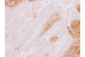 IHC-P Image TXNDC3 antibody [N3C3] detects TXNDC3 protein at cytoplasm on Cal27 xenograft by immunohistochemical analysis.