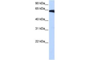 Western Blotting (WB) image for anti-Phosphatidylinositol Glycan W (PIGW) antibody (ABIN2463266) (PIGW anticorps)