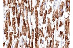 ABIN6266951 at 1/100 staining human Heart muscle tissue sections by IHC-P.