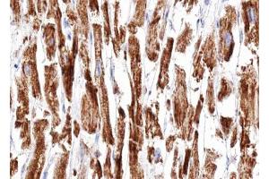 ABIN6266951 at 1/100 staining human Heart muscle tissue sections by IHC-P. (DOK7 anticorps  (C-Term))