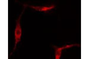 ABIN6267332 staining Hela cells by IF/ICC.
