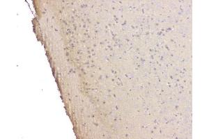 IHC analysis of SRCIN1 using anti-SRCIN1 antibody (ABIN6719623).