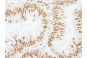 Immunohistochemistry (IHC) image for anti-Cleavage Stimulation Factor, 3' Pre-RNA, Subunit 2, 64kDa (CSTF2) (AA 527-577) antibody (ABIN7448497)