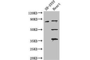 Western Blot Positive WB detected in: SH-SY5Y whole cell lysate, Mouse heart tissue All lanes: MAPT antibody at 3. (MAPT anticorps  (AA 33-166))