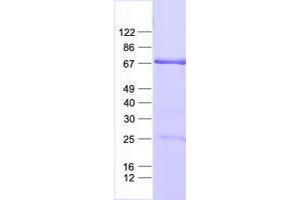 Validation with Western Blot