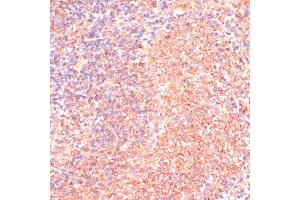 Immunohistochemistry of paraffin-embedded rat spleen using IL4R antibody (ABIN7268001) at dilution of 1:100 (40x lens). (IL4 Receptor anticorps  (AA 26-232))