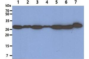 The Cell lysates (40ug) were resolved by SDS-PAGE, transferred to PVDF membrane and probed with anti-human PSME1 antibody (1:1000).