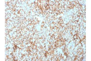Formalin-fixed, paraffin-embedded human Tonsil stained with CD73 Mouse Monoclonal Antibody (NT5E/2503).