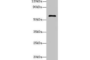 Western blot All lanes: GK5 antibody at 4 μg/mL + K562 whole cell lysate Secondary Goat polyclonal to rabbit IgG at 1/10000 dilution Predicted band size: 60, 34, 28 kDa Observed band size: 60 kDa (GK5 anticorps  (AA 96-301))