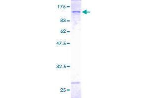 Image no. 1 for Cadherin 13 (CDH13) (AA 1-713) protein (GST tag) (ABIN1348892)