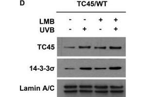 AKT cooperates with 14-3-3σ to facilitate nuclear translocation of TC45 in response to UVB irradiationWestern blot analysis of A.