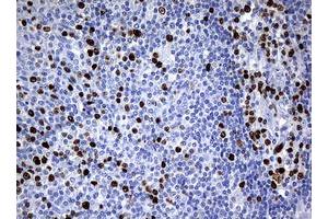 Image no. 2 for anti-Antigen Identified By Monoclonal Antibody Ki-67 (MKI67) (AA 1160-1493) antibody (ABIN1490859) (Ki-67 anticorps  (AA 1160-1493))
