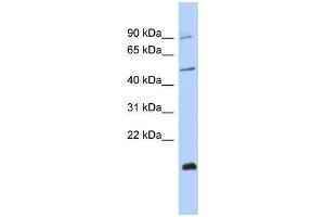 Human MCF-7; WB Suggested Anti-ZNF645 Antibody Titration: 0. (ZNF645 anticorps  (Middle Region))