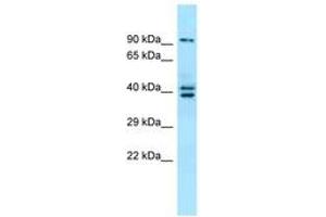 Image no. 1 for anti-L(3)mbt-Like 3 (L3MBTL3) (N-Term) antibody (ABIN6744892) (L3MBTL3 anticorps  (N-Term))
