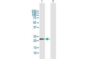 Western Blot analysis of NDUFB10 expression in transfected 293T cell line by NDUFB10 MaxPab polyclonal antibody.