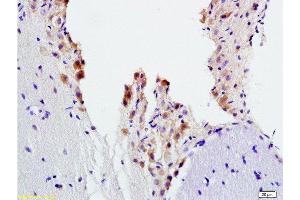 Formalin-fixed and paraffin embedded rat brain tissue labeled with Anti-ADRB2 Polyclonal Antibody, Unconjugated  at 1:200, followed by conjugation to the secondary antibody and DAB staining