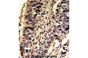 anti-Small Nuclear Ribonucleoprotein D2 Polypeptide 16.5kDa (SNRPD2) antibody