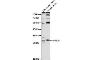 Western blot analysis of extracts of various cell lines, using Rnf170 antibody (ABIN7270065) at 1:1000 dilution.