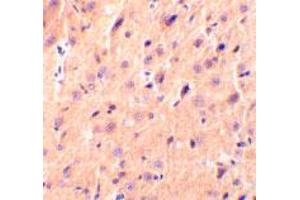 Immunohistochemical staining of rat brain tissue using CBLN1 polyclonal antibody  at 2 ug/mL .