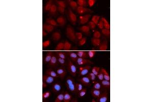 Immunofluorescence analysis of U2OS cells using RAG2 antibody.