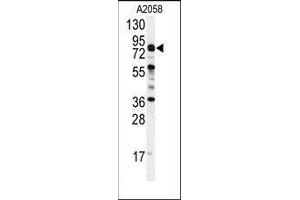 Western blot analysis of anti-COG4 Antibody (C-term) in A2058 cell line lysates (35ug/lane). (COG4 anticorps  (C-Term))