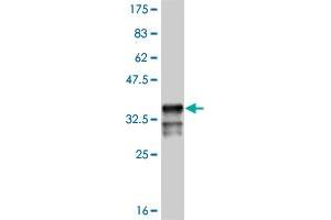 Western Blot detection against Immunogen (35. (MSX1 anticorps  (AA 216-297))