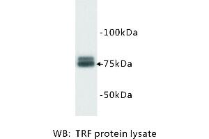 Image no. 1 for anti-Transferrin (TF) antibody (ABIN1112831)