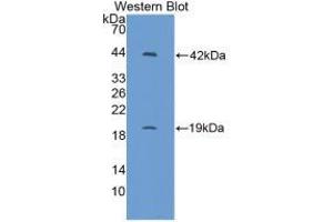 Western blot analysis of recombinant Mouse IL1R1. (IL1R1 anticorps  (AA 20-338))