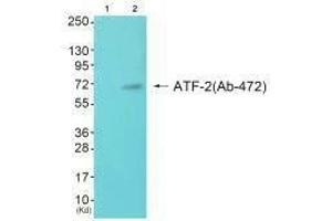 Western blot analysis of extracts from JK cells (Lane 2), using ATF-2 (Ab-472) antiobdy. (ATF2 anticorps  (Ser472))