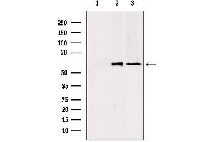 Western blot analysis of extracts from various samples, using PKLR antibody.