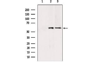 Western blot analysis of extracts from various samples, using PKLR antibody. (PKLR anticorps  (Internal Region))