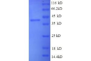 SDS-PAGE (SDS) image for Induced Myeloid Leukemia Cell Differentiation Protein Mcl-1 (MCL1) (AA 1-308), (partial) protein (His-SUMO Tag) (ABIN5709917)
