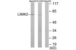 Western Blotting (WB) image for anti-LIM Domain Kinase 2 (LIMK2) (Internal Region) antibody (ABIN1849456) (LIMK2 anticorps  (Internal Region))
