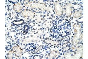 DDX17 antibody was used for immunohistochemistry at a concentration of 4-8 ug/ml to stain Epithelial cells of renal tubule (arrows) in Human Kidney.