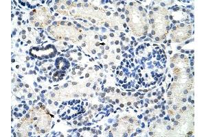 DDX17 antibody was used for immunohistochemistry at a concentration of 4-8 ug/ml to stain Epithelial cells of renal tubule (arrows) in Human Kidney. (DDX17 anticorps)