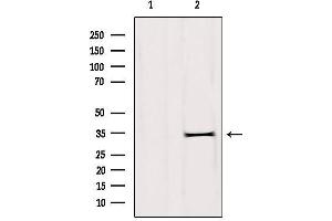 Western blot analysis of extracts from rat brain, using DHRS1 Antibody. (DHRS1 anticorps  (Internal Region))