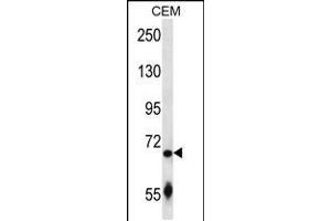 Western blot analysis in CEM cell line lysates (35ug/lane). (SLC27A3 anticorps  (N-Term))